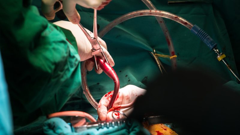 Deviația de sept: Operație endoscopică fără durere